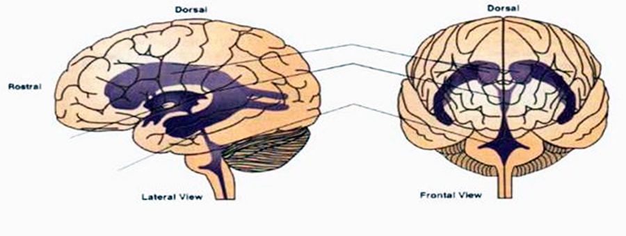 Equine brain, you can see the poor development of the frontal lobe.